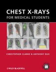 Chest X-Rays for Medical Students Paperback