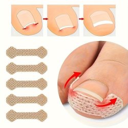 Professional Ingrown Toenail Corrector Strips - Painless Pedicure Foot Care Tool For Healthy Nails Oil-free