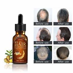Aoile Hair Care Essential Oil Hair Mask Essence Hair Growth Treatment LIQUID.30ML