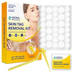 Skin Tag Remover Skin Tag Remover Device With 72 Pcs Repair Patches For Small To Medium 2MM To 4MM Sized Skin Tags Easy And Effective