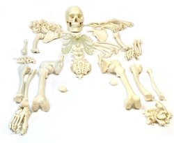 Disarticulated Human Skeleton Full Medical Quality Life Sized 62 Model Height - 23 Intevertebral Discs 3 Part Skull With Moveable Jaw Left Hand And Foot Jointed