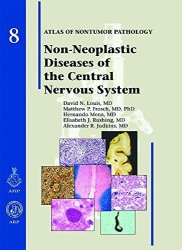 Non-neoplastic Diseases Of The Central Nervous System Atlas Of Nontumor Pathology First Series Fascicle