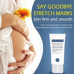 Aoile Mild Non-irritating Stretch Mark Cream For Pregnancy Repair Scar Slack Line Abdomen Stretch Marks Cream