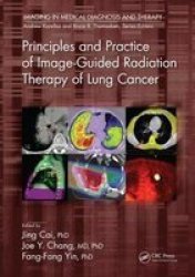 Principles And Practice Of Image-guided Radiation Therapy Of Lung Cancer Hardcover
